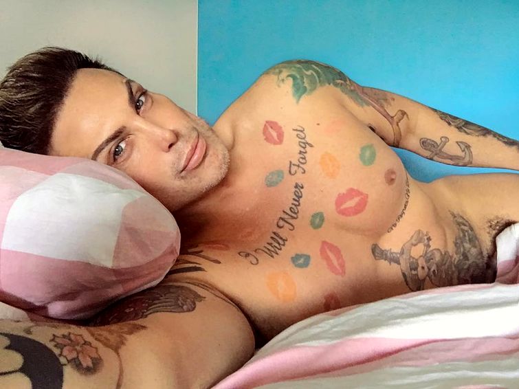 Невен Сиганович, постоянная эрекция после ринопластики, эрекция после анестезии, приапизм