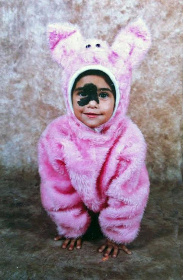 Мариана Мендес, Mariana Mendes, девушка с родимым пятном на лице, огромное родимое пятно на лице, огромная родина на лице