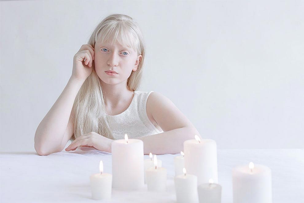 люди-альбиносы, фото людей альбиносов, Юлия Тейтс, Yulia Taits