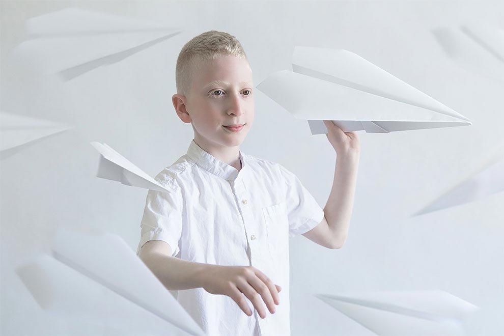 люди-альбиносы, фото людей альбиносов, Юлия Тейтс, Yulia Taits