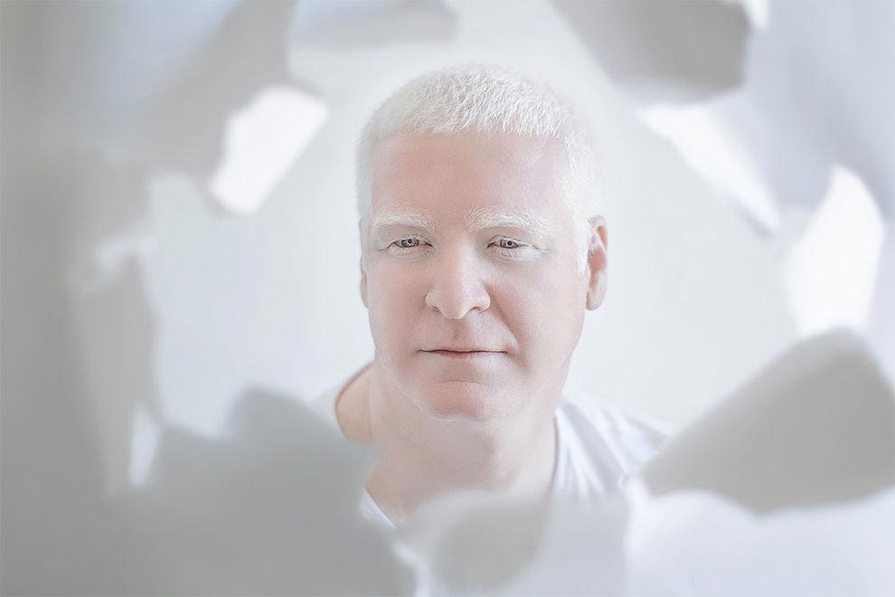 люди-альбиносы, фото людей альбиносов, Юлия Тейтс, Yulia Taits