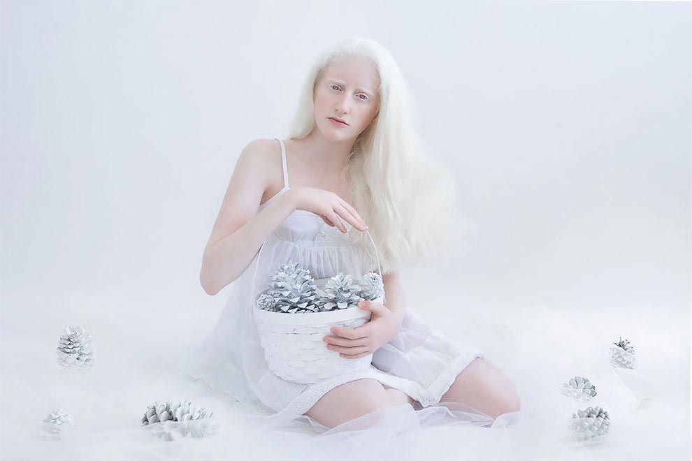 люди-альбиносы, фото людей альбиносов, Юлия Тейтс, Yulia Taits