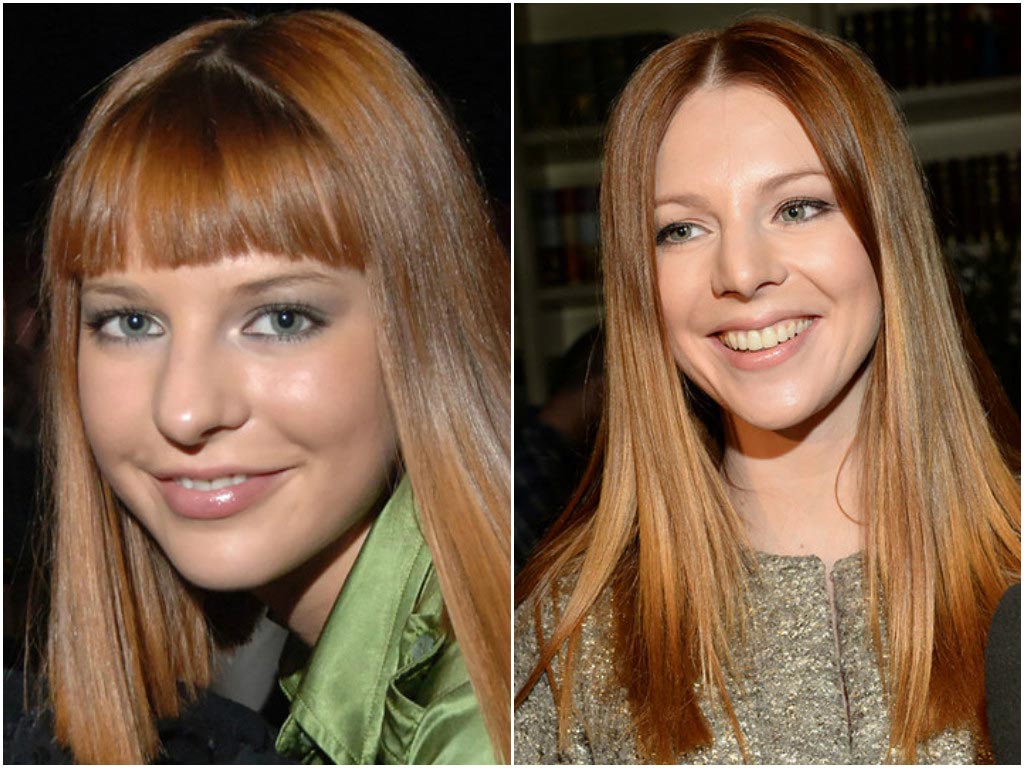 10 знаменитостей, сделавших пластические операции в юном возрасте пластические операции звёзд, звёзды сделавшие пластические операции в юном возрасте