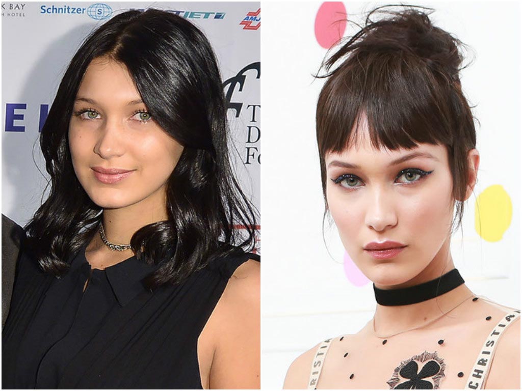 10 знаменитостей, сделавших пластические операции в юном возрасте пластические операции звёзд, звёзды сделавшие пластические операции в юном возрасте