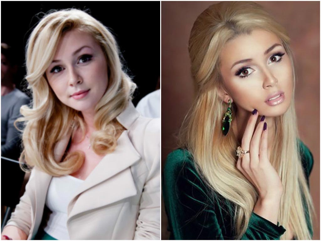 10 знаменитостей, сделавших пластические операции в юном возрасте пластические операции звёзд, звёзды сделавшие пластические операции в юном возрасте