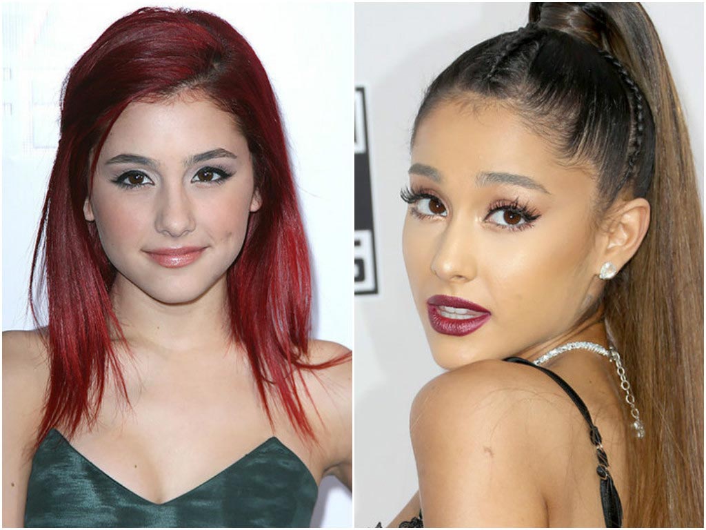 10 знаменитостей, сделавших пластические операции в юном возрасте пластические операции звёзд, звёзды сделавшие пластические операции в юном возрасте