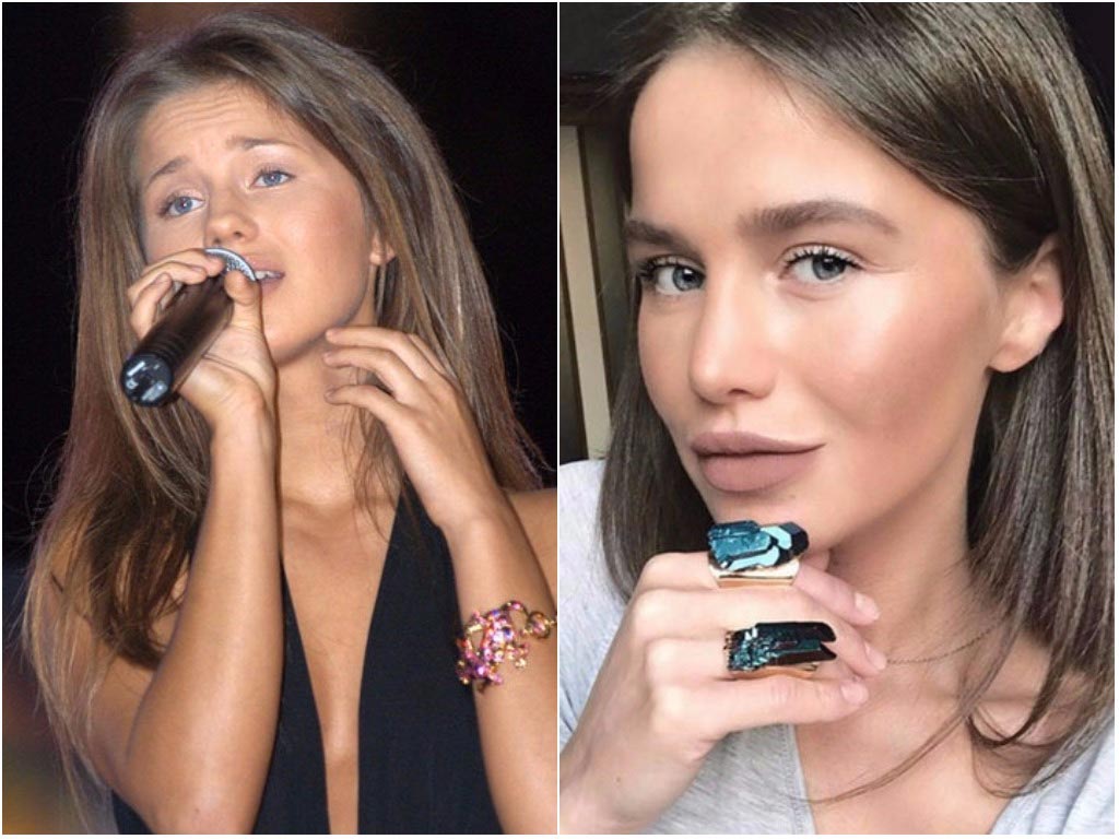 знаменитости после пластики, звёзды до и после пластических операций