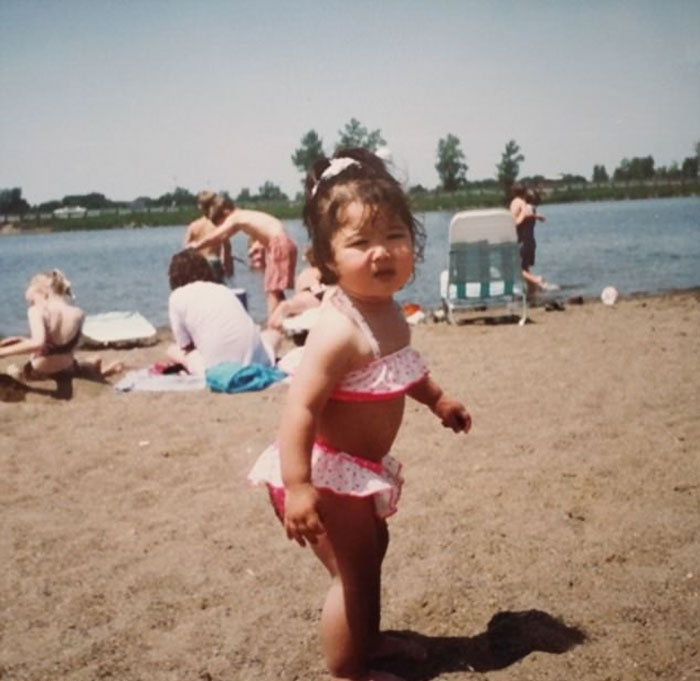 26-летняя модель которая выглядит на 50, Сара Гюртс, Синдром Элерса-Данлоса