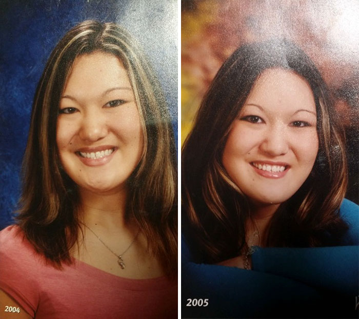 26-летняя модель которая выглядит на 50, Сара Гюртс, Синдром Элерса-Данлоса