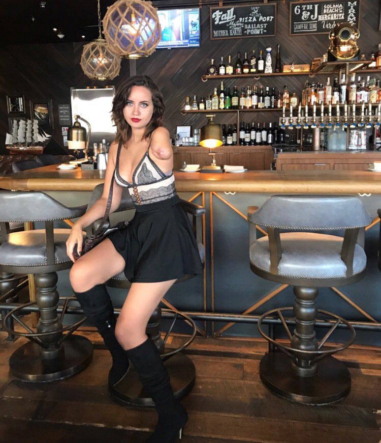 модель с одной рукой, сексуальные снимки с одной рукой, девушка с одной рукой сексуальные снимки