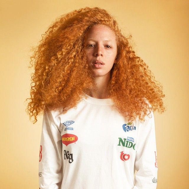 девушки с необычной внешностью, люди с дефектами 