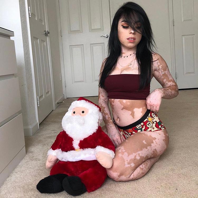 девушки с необычной внешностью, люди с дефектами 