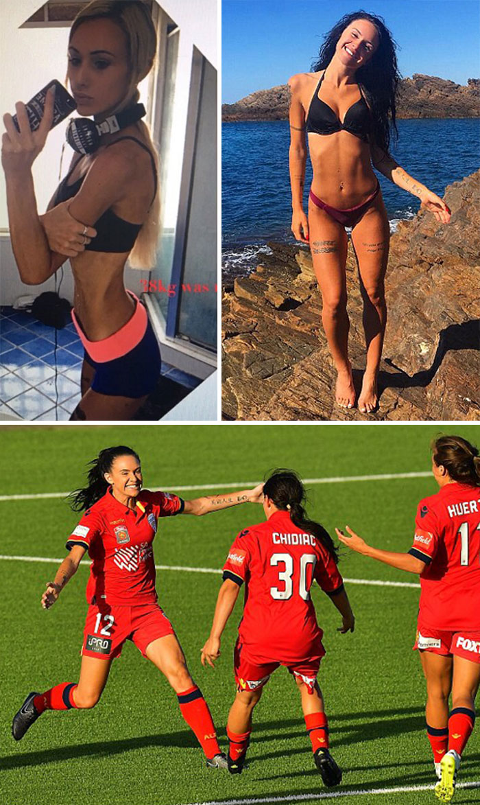 до и после анорексии, люди которые смогли победить анорексию