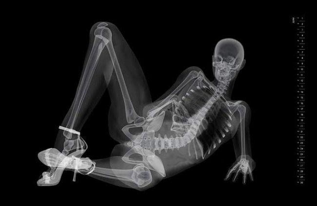 пинап-календарь рентген, рентген вместо фотоаппарата, рентгеновские снимки моделей