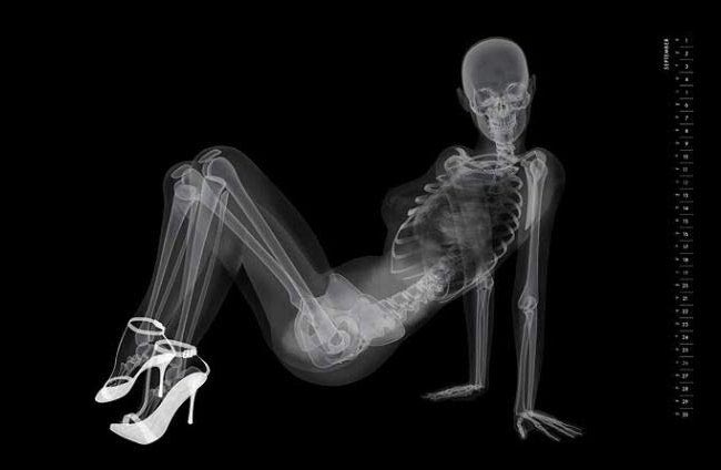 пинап-календарь рентген, рентген вместо фотоаппарата, рентгеновские снимки моделей