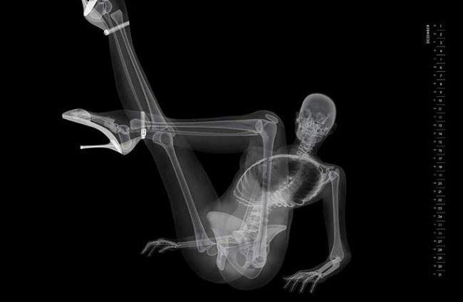 пинап-календарь рентген, рентген вместо фотоаппарата, рентгеновские снимки моделей