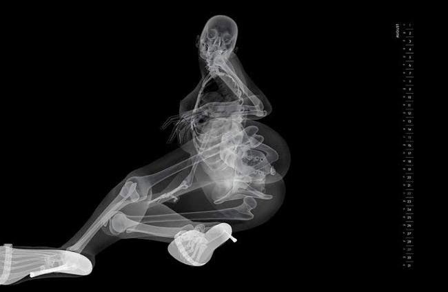 пинап-календарь рентген, рентген вместо фотоаппарата, рентгеновские снимки моделей