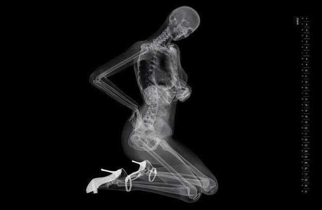 пинап-календарь рентген, рентген вместо фотоаппарата, рентгеновские снимки моделей