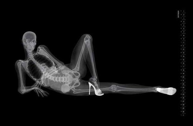 пинап-календарь рентген, рентген вместо фотоаппарата, рентгеновские снимки моделей