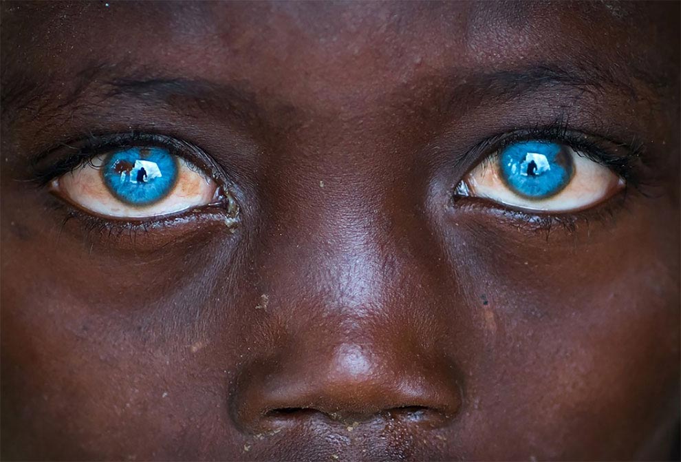 Темнокожие люди с голубыми глазами фото