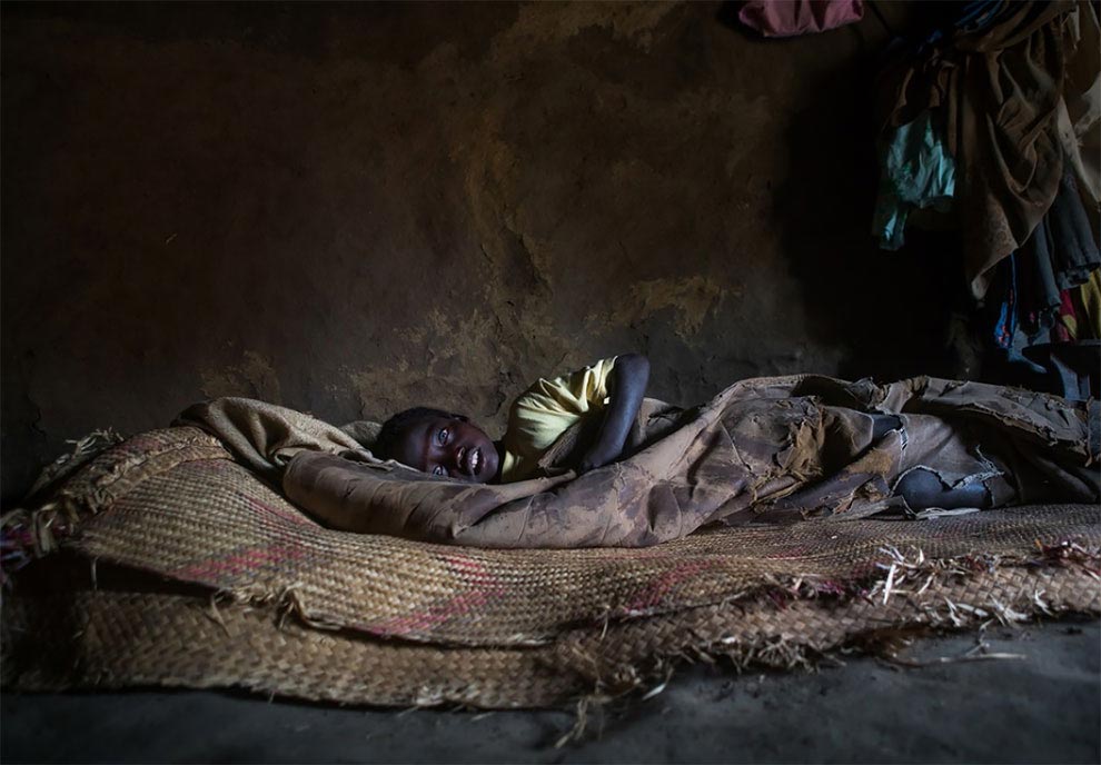 африканский мальчик с голубыми глазами, темнокожий мальчик с голубыми глазами, негр с голубыми глазами, синдром Ваарденбурга