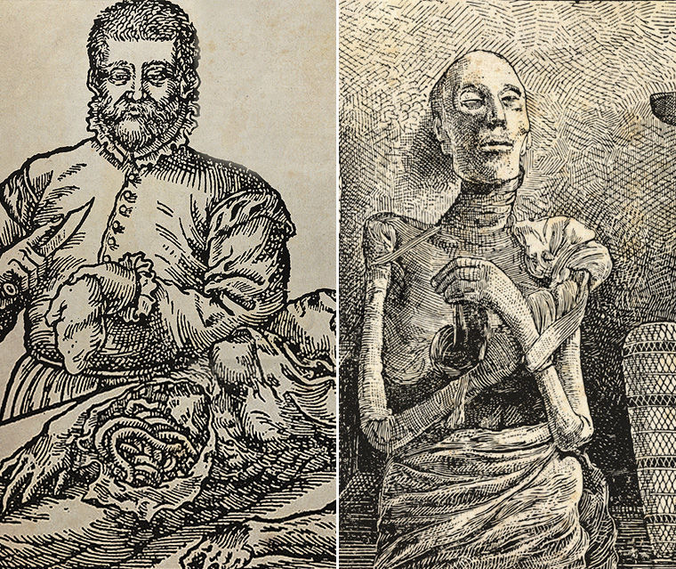 истории о каннибализме, медицинский каннибализм