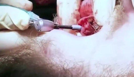 Вот как будут выглядеть зубы, если не чистить их 20 лет парень не чистил зубы 20 лет, что будет если не чистить зубы 20 лет