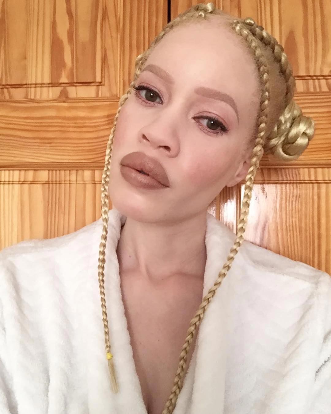 Диандра Форрест, Диандра Форрест фото, Диандра Форрест биография, афроамериканская модель альбинос