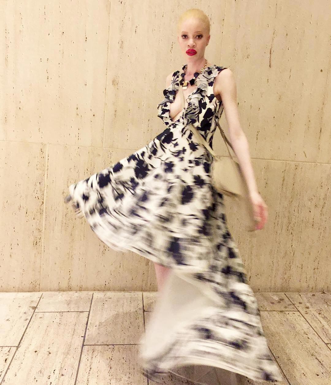 Диандра Форрест, Диандра Форрест фото, Диандра Форрест биография, афроамериканская модель альбинос