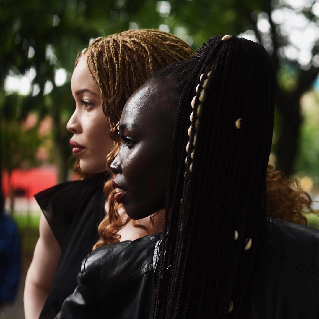 Диандра Форрест, Диандра Форрест фото, Диандра Форрест биография, афроамериканская модель альбинос