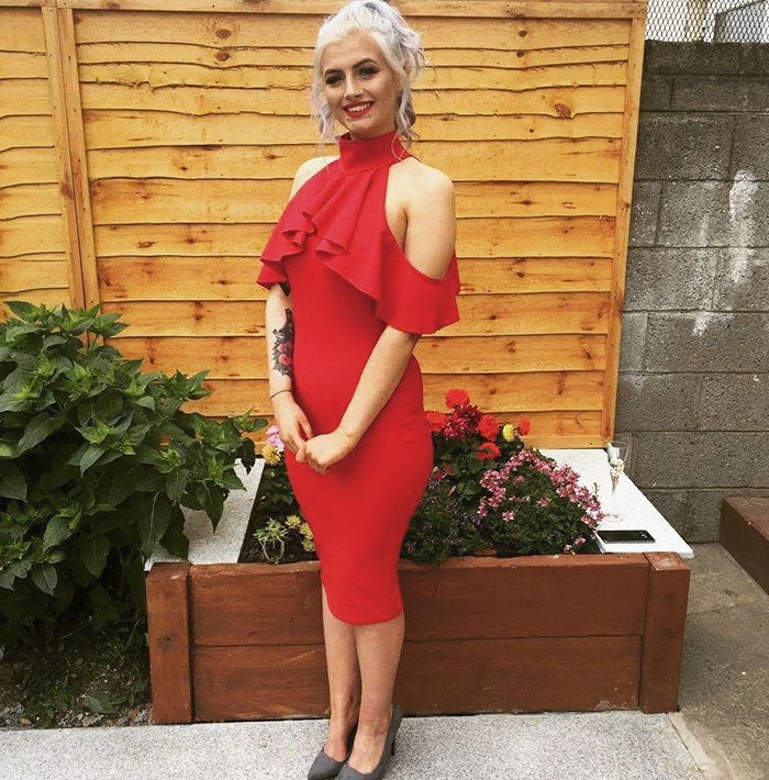 Девушка хотела перекрыть свои шрамы татуировками но все мастера отказывали ей,  Ифа Ловетт, Aoife Lovett