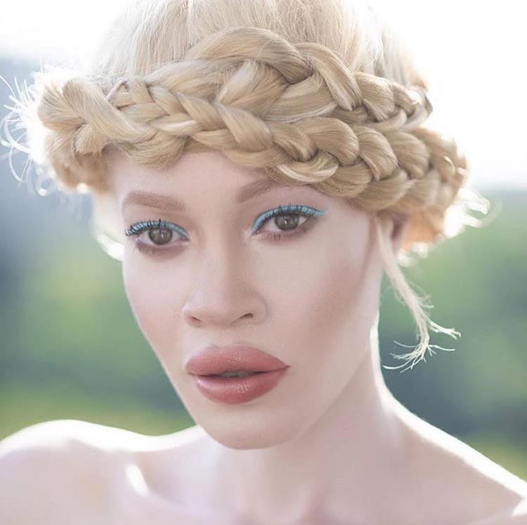 Диандра Форрест — афроамериканская модель-альбинос пошатнувшая традиционные  понятия красоты