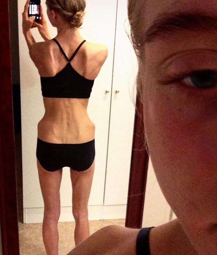 Малин Олоффсон, Malin Oloffson, что ПМС может сделать с телом, как выглядит женское тело во время ПМС