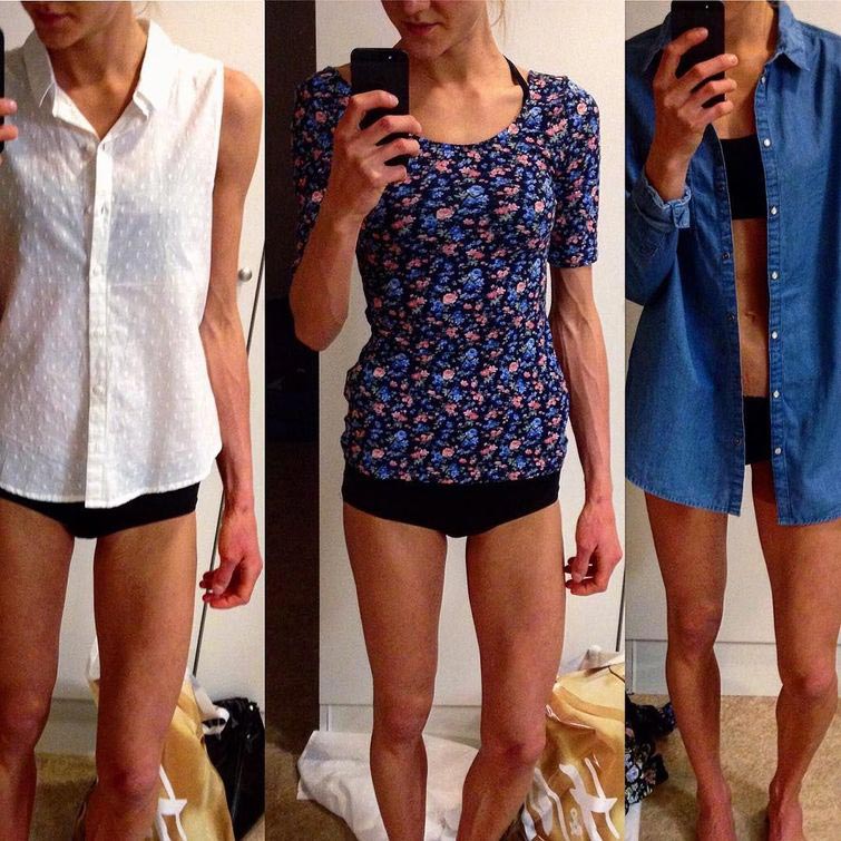 Малин Олоффсон, Malin Oloffson, что ПМС может сделать с телом, как выглядит женское тело во время ПМС