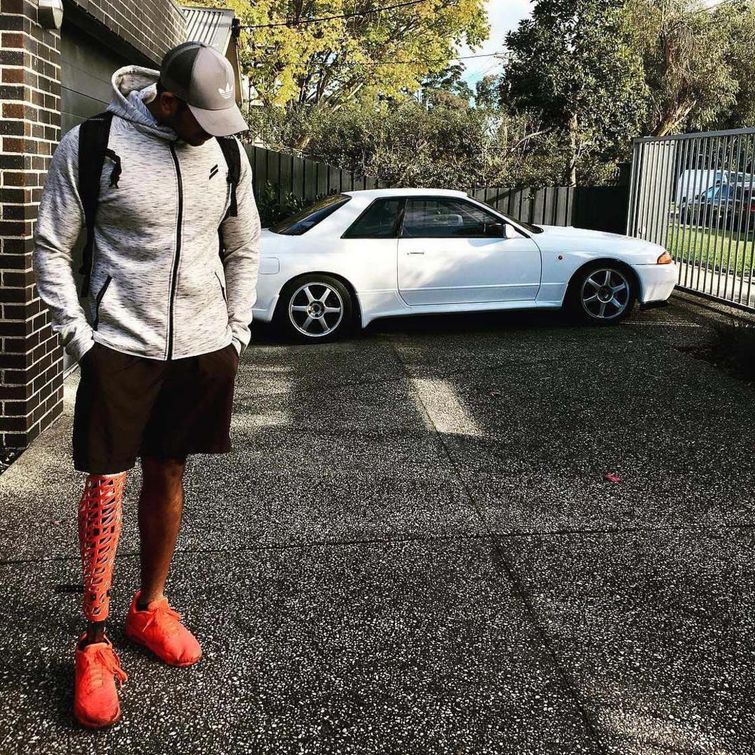 дизайнерские протезы, протезы ног дизайн, протезы ног модный аксессуар