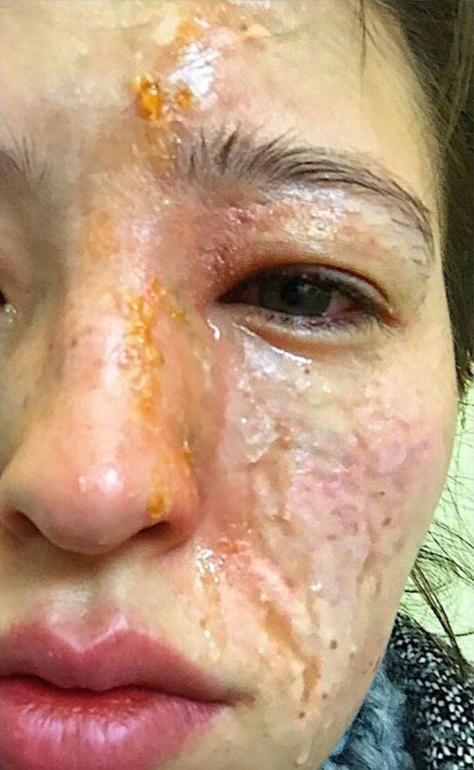 увлажнитель воздуха эфирные масла, увлажнитель воздуха эфирные масла опасность, аромадиффузор, ароматический диффузор