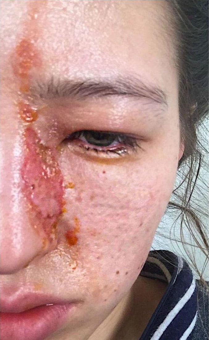 увлажнитель воздуха эфирные масла, увлажнитель воздуха эфирные масла опасность, аромадиффузор, ароматический диффузор