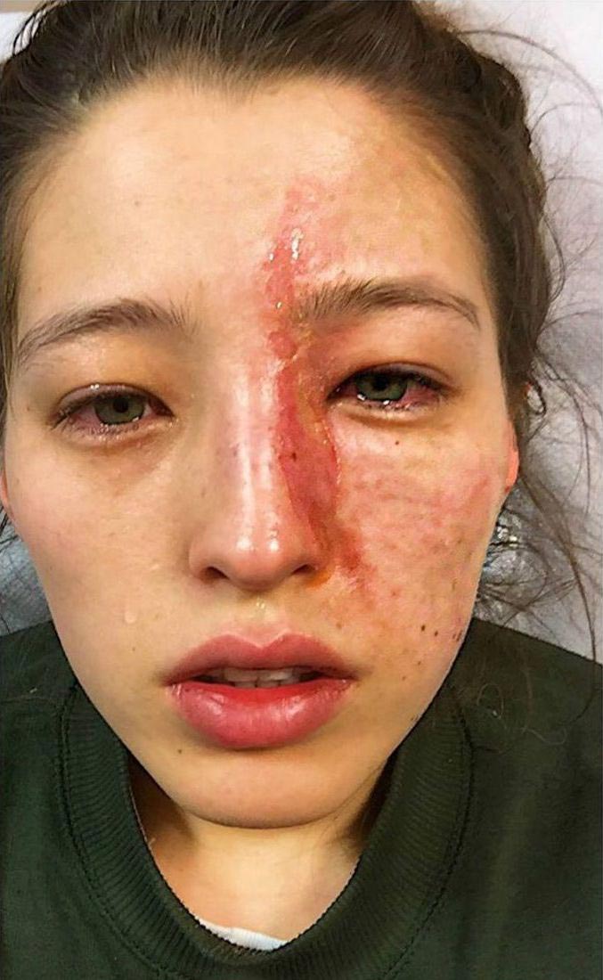 увлажнитель воздуха эфирные масла, увлажнитель воздуха эфирные масла опасность, аромадиффузор, ароматический диффузор