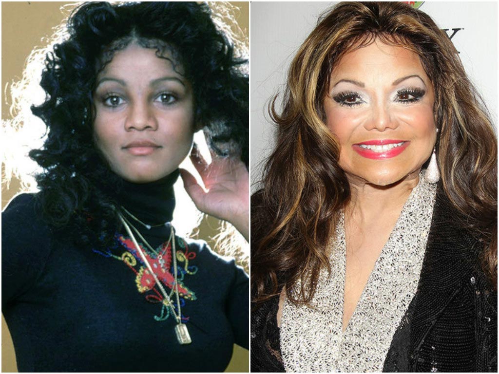 неудачные пластические операции звёзд, звёзды с неудачной пластикой