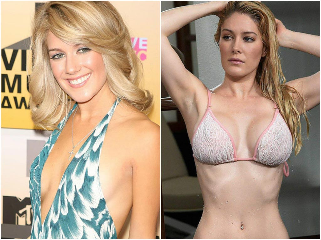 неудачные пластические операции звёзд, звёзды с неудачной пластикой