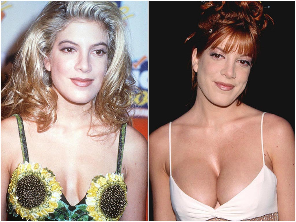 неудачные пластические операции звёзд, звёзды с неудачной пластикой