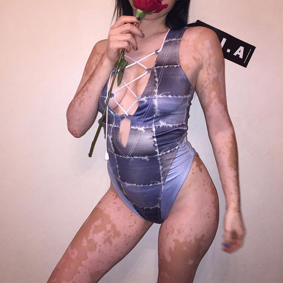 Люди издевались над этой девушкой с витилиго, но она смогла превратить свою болезнь в искусство в серии горячих фотографий издевались над девушкой с витилиго, модель с витилиго, Эшли Сото, Ashley Soto, инстаграм Эшли Сото