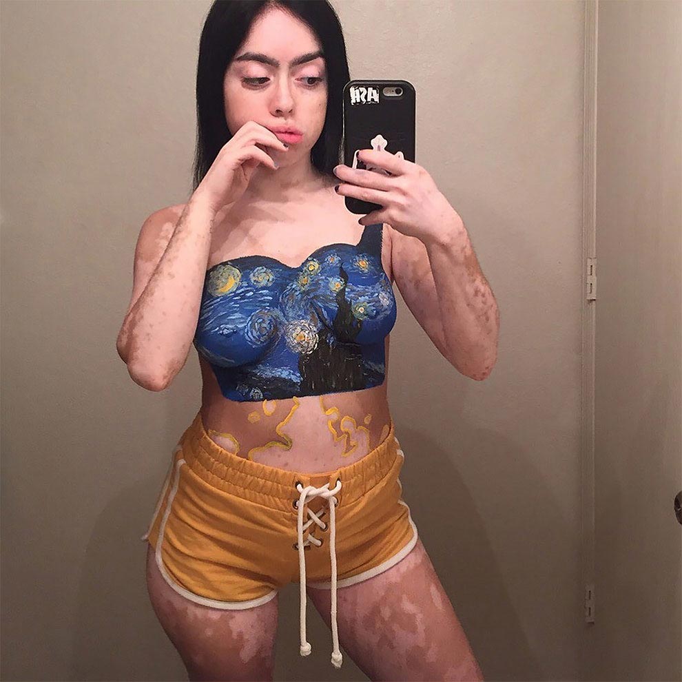 Люди издевались над этой девушкой с витилиго, но она смогла превратить свою болезнь в искусство в серии горячих фотографий издевались над девушкой с витилиго, модель с витилиго, Эшли Сото, Ashley Soto, инстаграм Эшли Сото