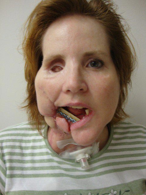 жизнь после самоубийства, пережила попытку самоубийства, жизнь после неудачной попытки самоубийства, лицо после попытки самоубийства