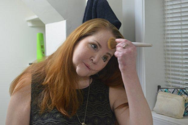 жизнь после самоубийства, пережила попытку самоубийства, жизнь после неудачной попытки самоубийства, лицо после попытки самоубийства