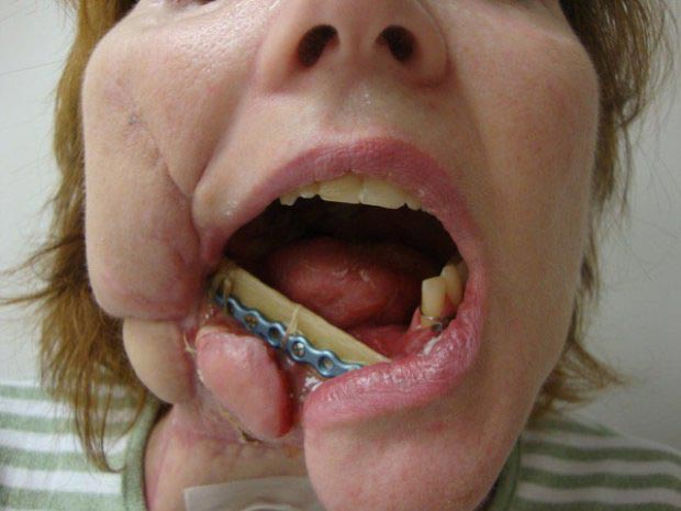 жизнь после самоубийства, пережила попытку самоубийства, жизнь после неудачной попытки самоубийства, лицо после попытки самоубийства