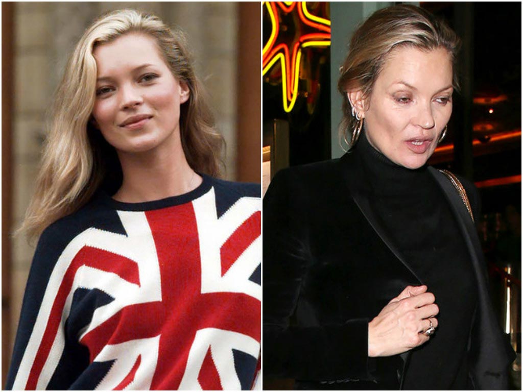 звёзды изменившиеся до неузнаваемости, звёзды которых не узнать