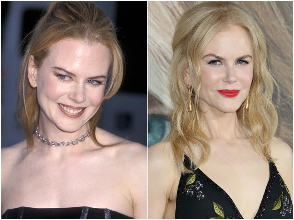 звёзды изменившиеся до неузнаваемости, звёзды которых не узнать