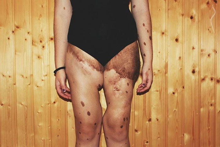 девушка с 500 родинками, Альба Парехо, Alba Parejo