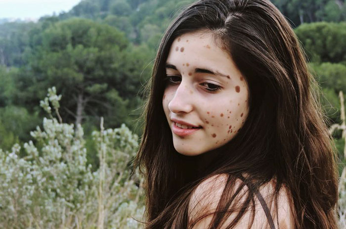 девушка с 500 родинками, Альба Парехо, Alba Parejo